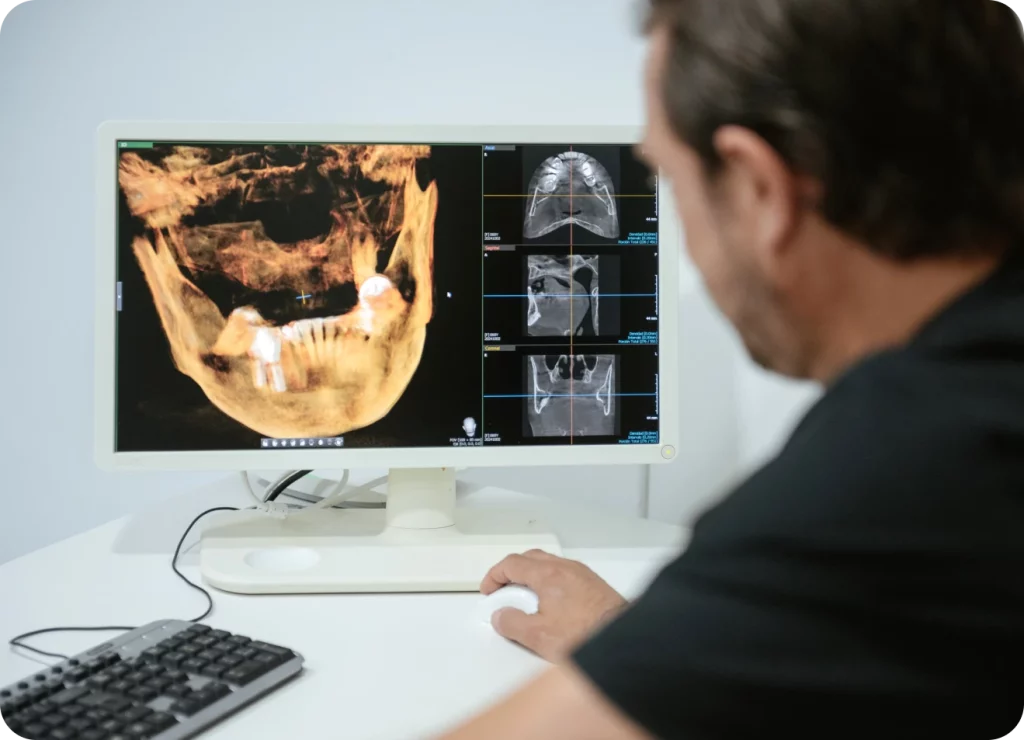 Diseño de sonrisa con estética dental